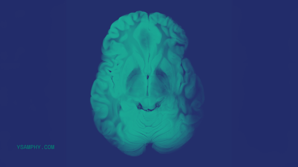 brain